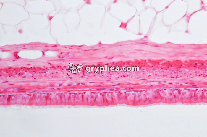 Trachée x100 - gryphea.com